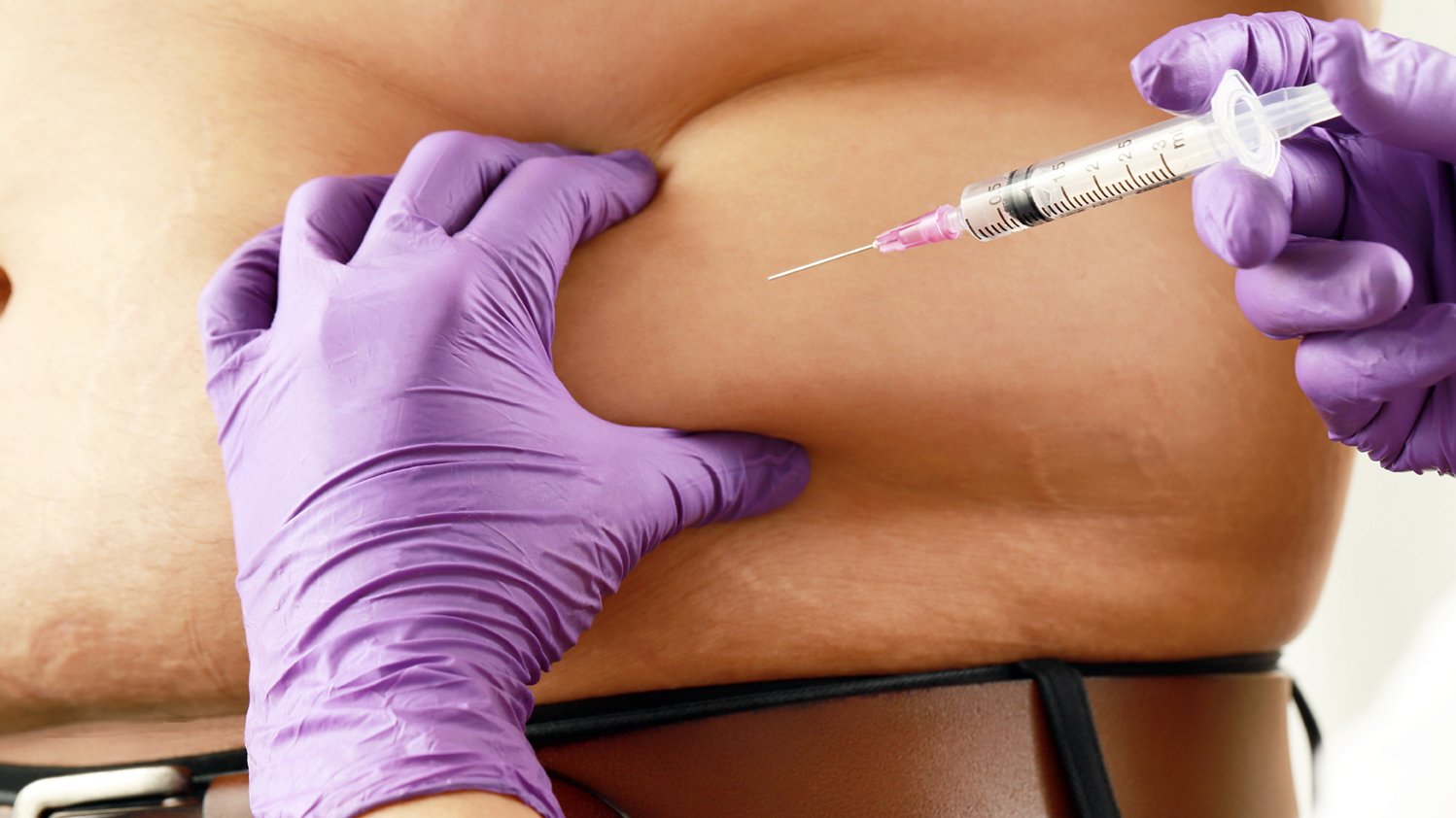How Long Do fat-dissolving Injections Take to Work